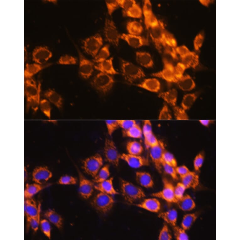 Immunofluorescence - Anti-ACAT1 Antibody (A5335) - Antibodies.com