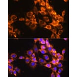 Immunofluorescence - Anti-ACAT1 Antibody (A5335) - Antibodies.com