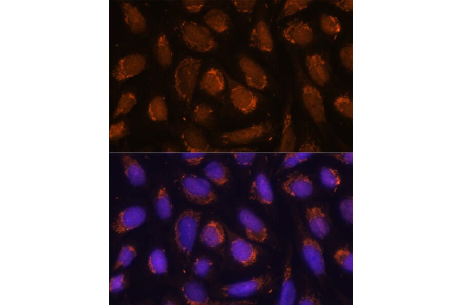 Immunofluorescence - Anti-ACAT1 Antibody (A5335) - Antibodies.com