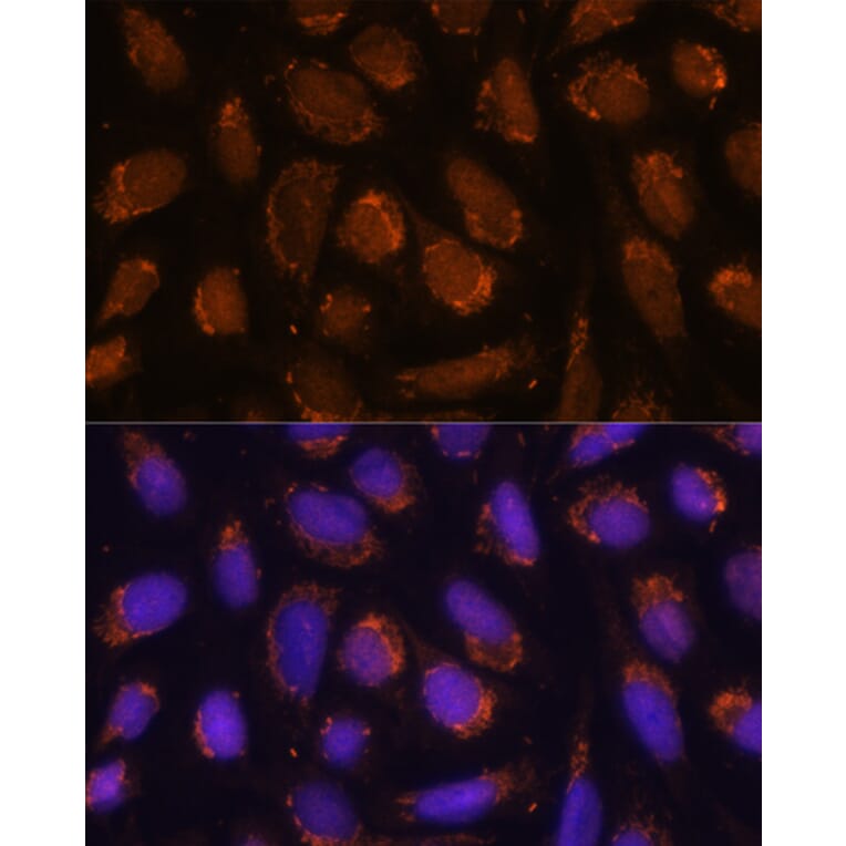 Immunofluorescence - Anti-ACAT1 Antibody (A5335) - Antibodies.com