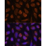 Immunofluorescence - Anti-ACAT1 Antibody (A5335) - Antibodies.com