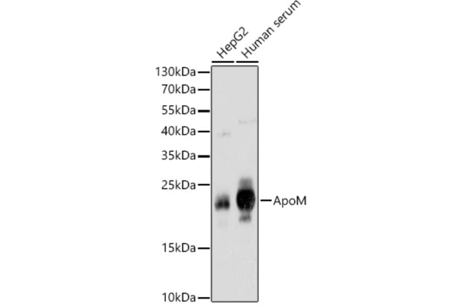Western Blot - Anti-Apo-M Antibody (A14680) - Antibodies.com