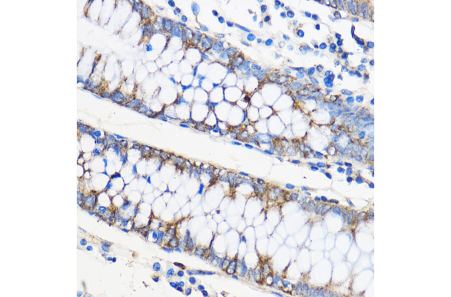 Immunohistochemistry - Anti-Apo-M Antibody (A14680) - Antibodies.com