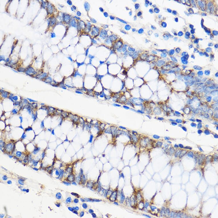 Immunohistochemistry - Anti-Apo-M Antibody (A14680) - Antibodies.com