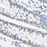 Immunohistochemistry - Anti-Apo-M Antibody (A14680) - Antibodies.com