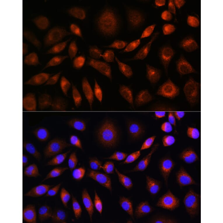 Immunofluorescence - Anti-Apo-M Antibody (A14680) - Antibodies.com
