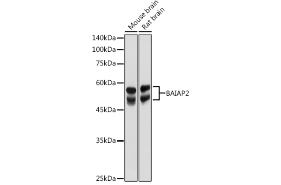 Western Blot - Anti-IRSp53 Antibody (A14681) - Antibodies.com