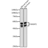 Western Blot - Anti-IRSp53 Antibody (A14681) - Antibodies.com