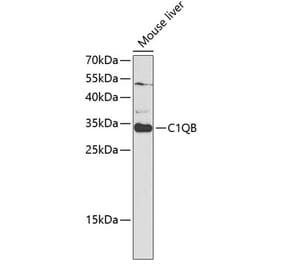 Western Blot - Anti-C1QB Antibody (A14682) - Antibodies.com