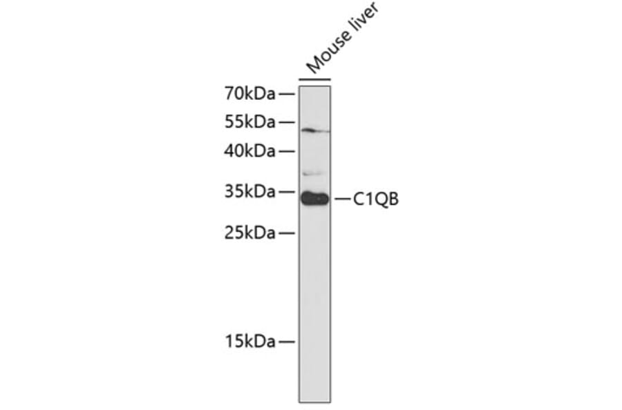 Western Blot - Anti-C1QB Antibody (A14682) - Antibodies.com