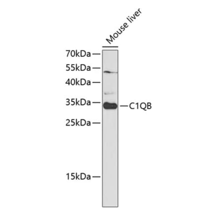 Western Blot - Anti-C1QB Antibody (A14682) - Antibodies.com