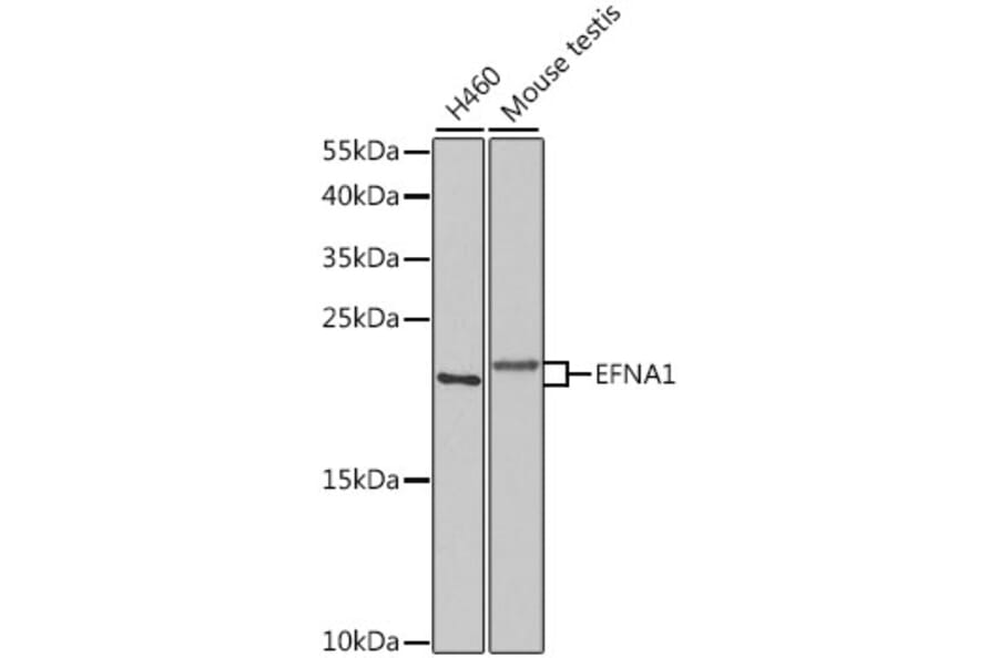 Western Blot - Anti-Ephrin A1 Antibody (A14683) - Antibodies.com