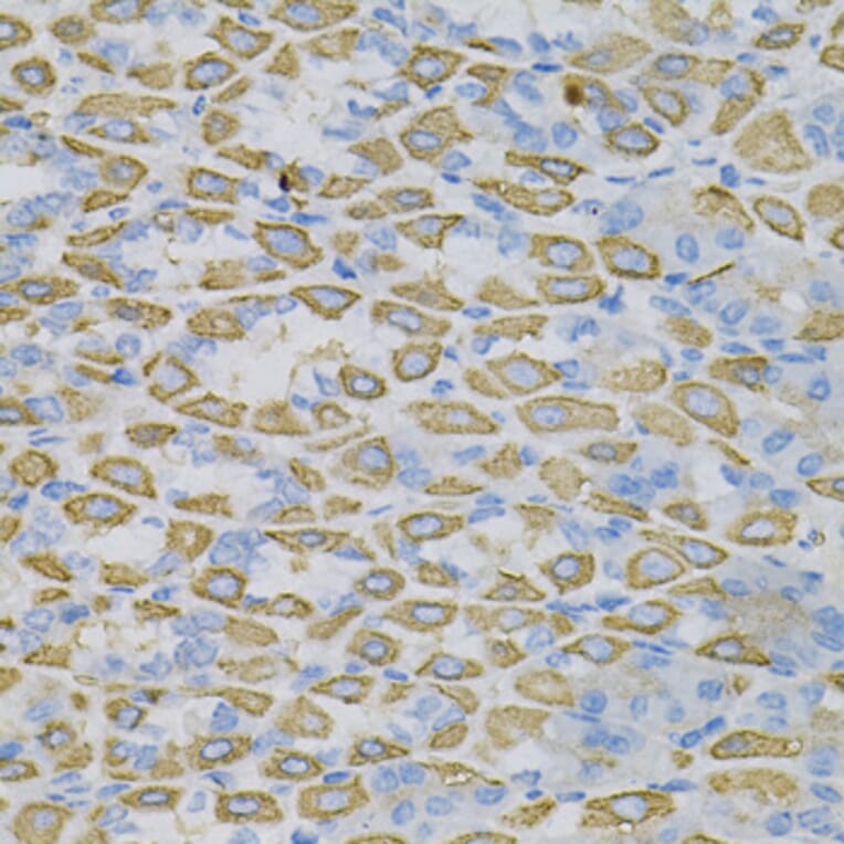 Immunohistochemistry - Anti-Ephrin A1 Antibody (A14683) - Antibodies.com