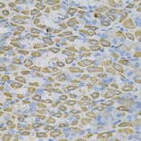 Immunohistochemistry - Anti-Ephrin A1 Antibody (A14683) - Antibodies.com