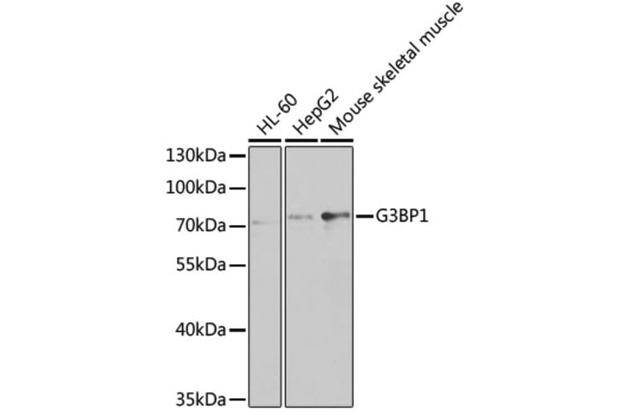 Western Blot - Anti-G3BP1 Antibody (A5342) - Antibodies.com