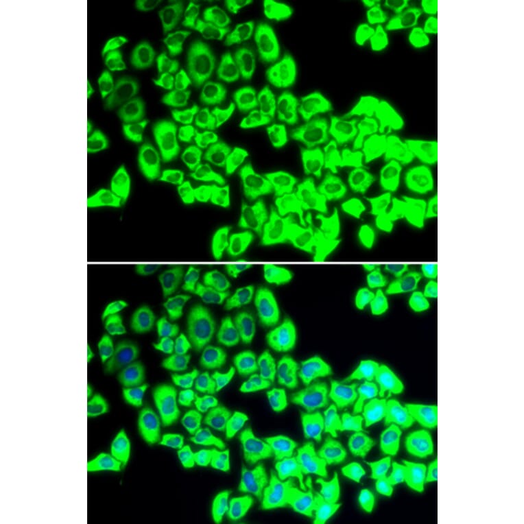 Immunofluorescence - Anti-G3BP1 Antibody (A5342) - Antibodies.com