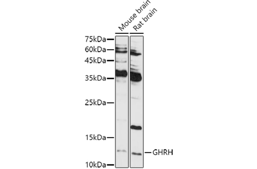 Western Blot - Anti-GHRH Antibody (A14685) - Antibodies.com
