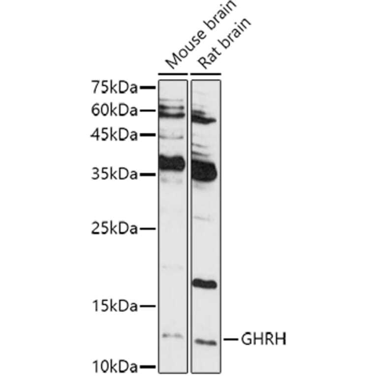 Western Blot - Anti-GHRH Antibody (A14685) - Antibodies.com