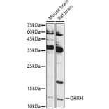 Western Blot - Anti-GHRH Antibody (A14685) - Antibodies.com