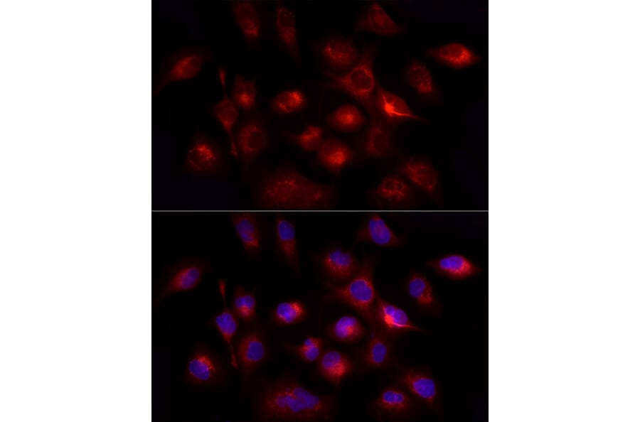 Immunofluorescence - Anti-GHRH Antibody (A14685) - Antibodies.com