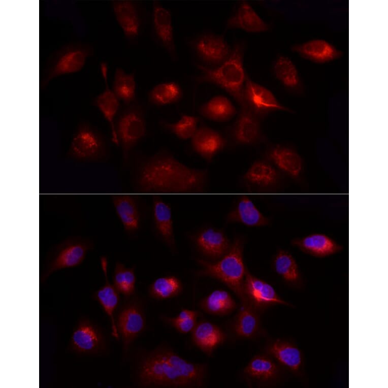 Immunofluorescence - Anti-GHRH Antibody (A14685) - Antibodies.com