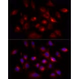 Immunofluorescence - Anti-GHRH Antibody (A14685) - Antibodies.com
