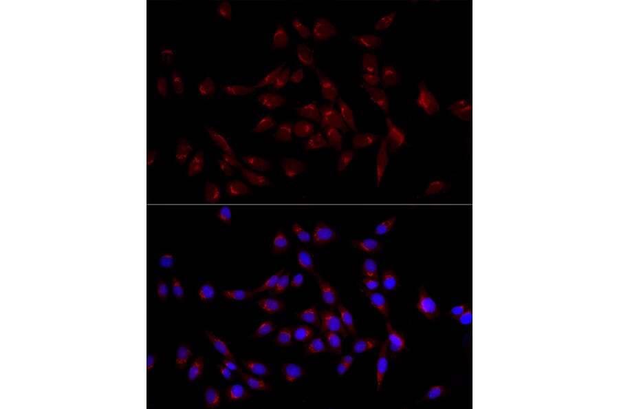 Immunofluorescence - Anti-GM130 Antibody (A14686) - Antibodies.com