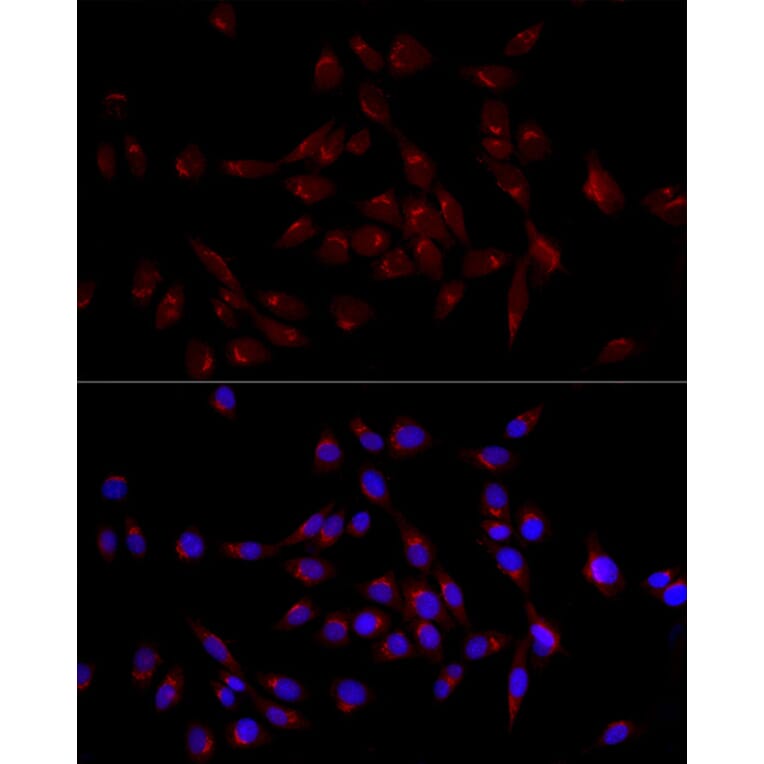 Immunofluorescence - Anti-GM130 Antibody (A14686) - Antibodies.com