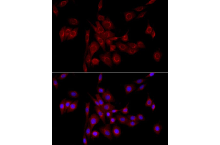 Immunofluorescence - Anti-GM130 Antibody (A14686) - Antibodies.com