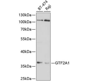 Western Blot - Anti-GTF2A1 Antibody (A14687) - Antibodies.com