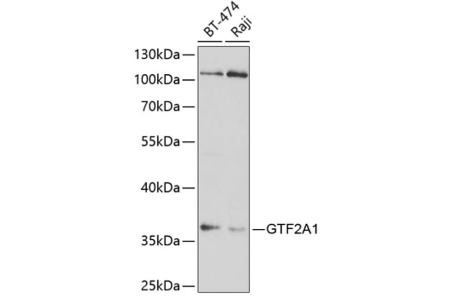 Western Blot - Anti-GTF2A1 Antibody (A14687) - Antibodies.com