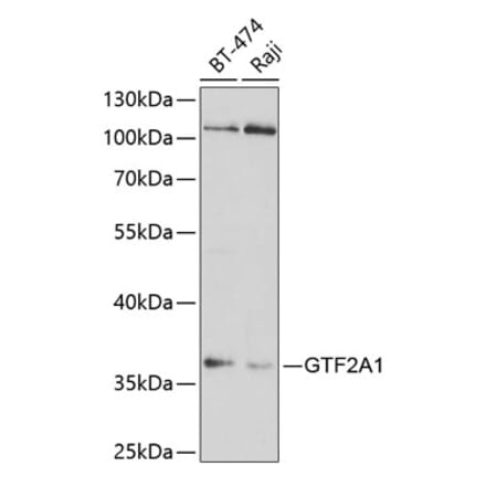 Western Blot - Anti-GTF2A1 Antibody (A14687) - Antibodies.com