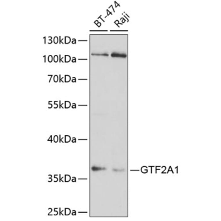 Western Blot - Anti-GTF2A1 Antibody (A14687) - Antibodies.com