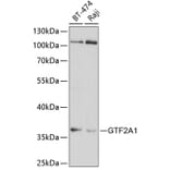 Western Blot - Anti-GTF2A1 Antibody (A14687) - Antibodies.com