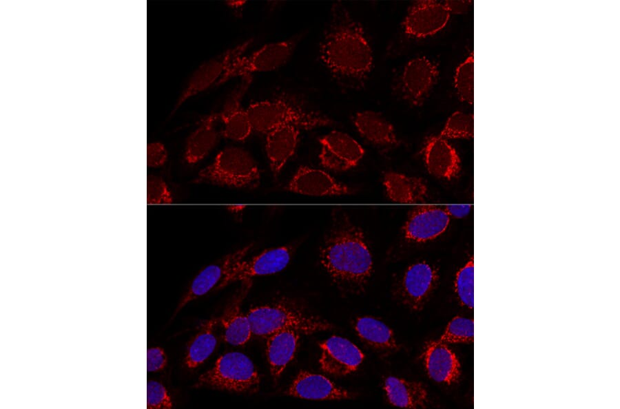 Immunofluorescence - Anti-HADHA Antibody (A14688) - Antibodies.com