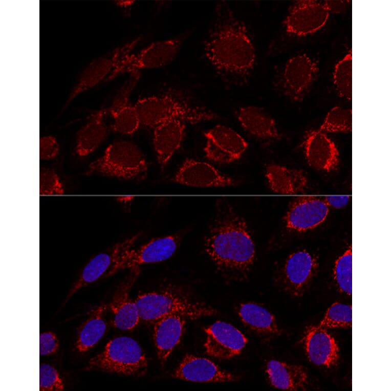 Immunofluorescence - Anti-HADHA Antibody (A14688) - Antibodies.com