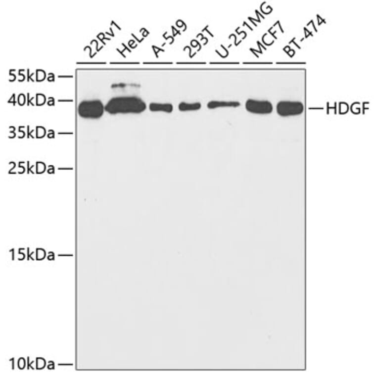 Western Blot - Anti-HDGF Antibody (A14689) - Antibodies.com