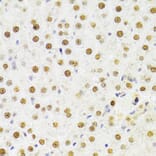 Immunohistochemistry - Anti-HDGF Antibody (A14689) - Antibodies.com