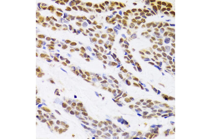 Immunohistochemistry - Anti-HDGF Antibody (A14689) - Antibodies.com