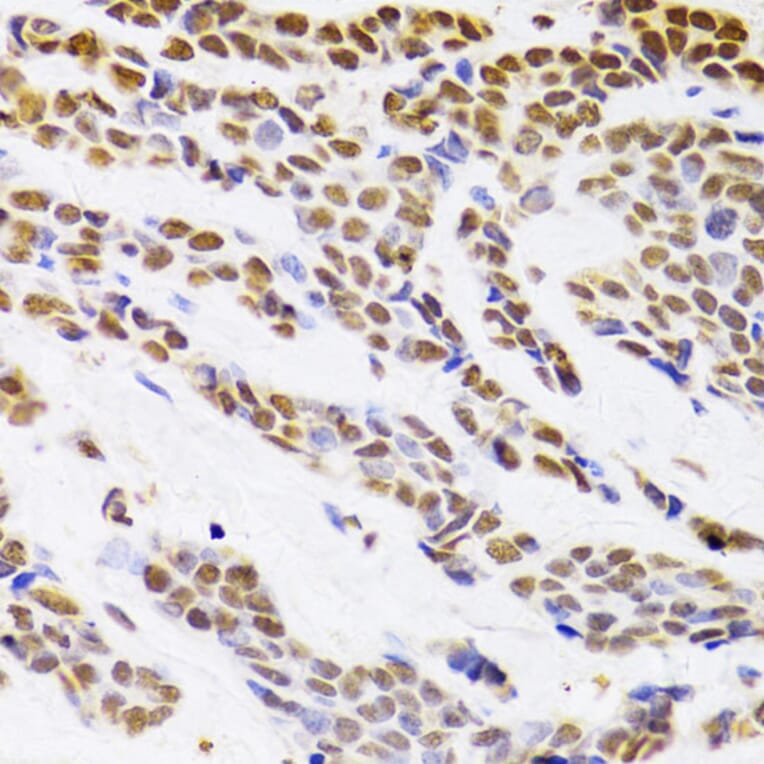 Immunohistochemistry - Anti-HDGF Antibody (A14689) - Antibodies.com