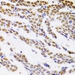 Immunohistochemistry - Anti-HDGF Antibody (A14689) - Antibodies.com