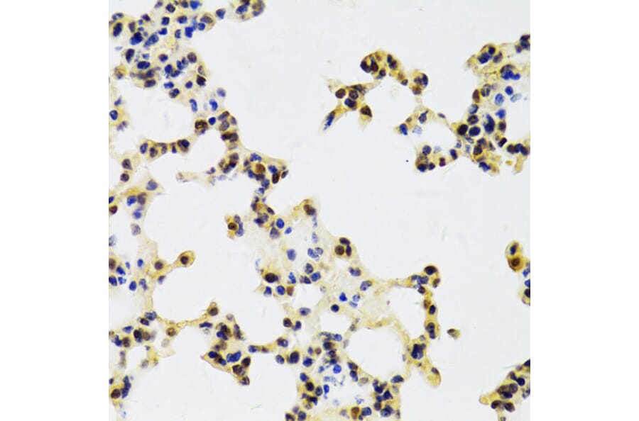 Immunohistochemistry - Anti-HDGF Antibody (A14689) - Antibodies.com