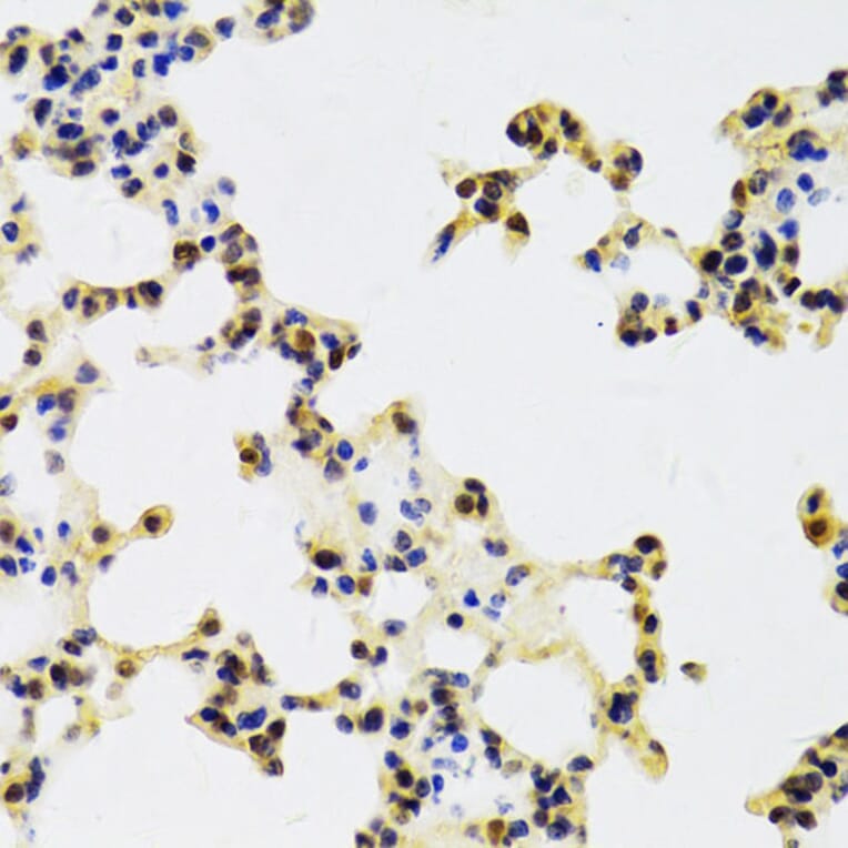 Immunohistochemistry - Anti-HDGF Antibody (A14689) - Antibodies.com