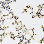 Immunohistochemistry - Anti-HDGF Antibody (A14689) - Antibodies.com
