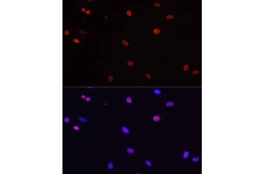 Immunofluorescence - Anti-HDGF Antibody (A14689) - Antibodies.com