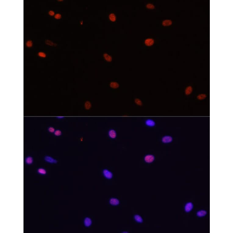 Immunofluorescence - Anti-HDGF Antibody (A14689) - Antibodies.com
