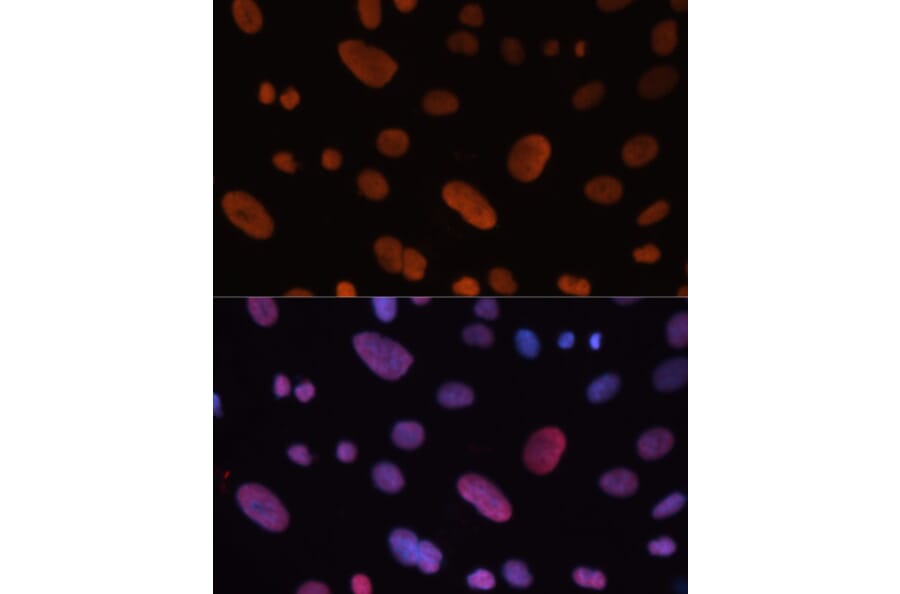 Immunofluorescence - Anti-HDGF Antibody (A14689) - Antibodies.com