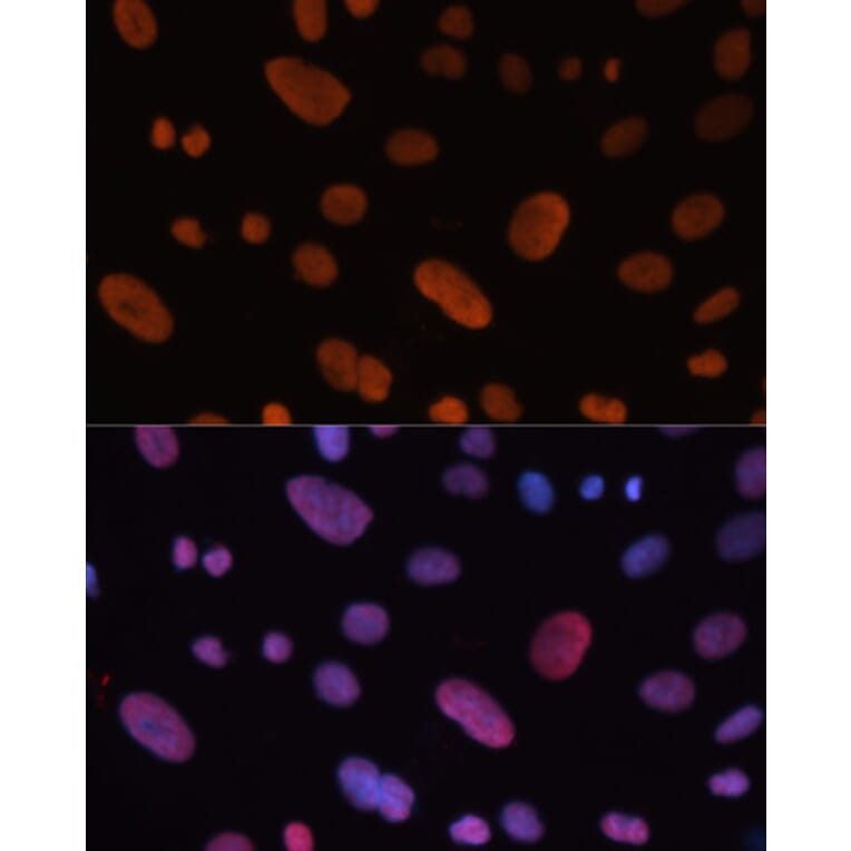Immunofluorescence - Anti-HDGF Antibody (A14689) - Antibodies.com