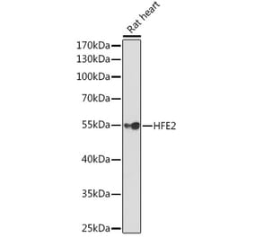 Western Blot - Anti-Hemojuvelin Antibody (A14690) - Antibodies.com