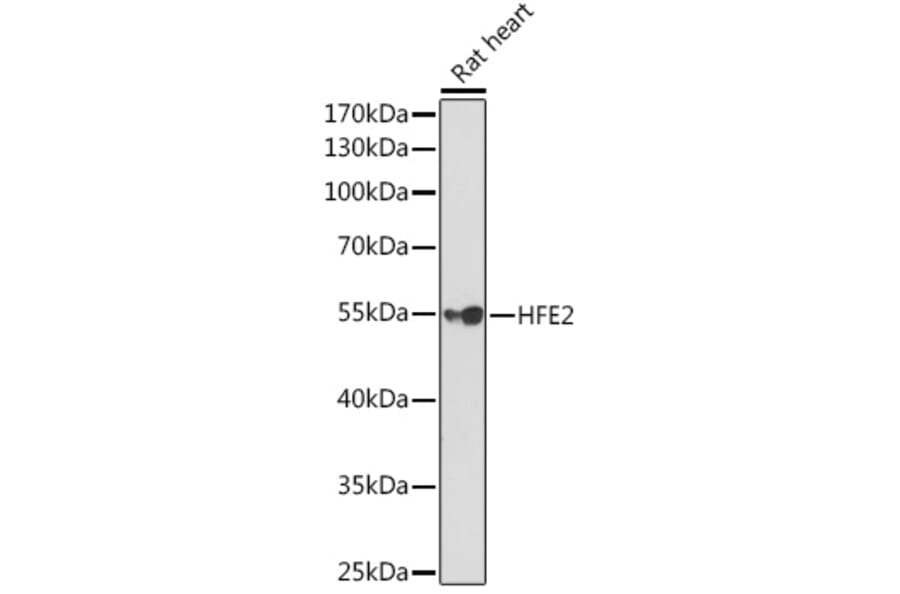 Western Blot - Anti-Hemojuvelin Antibody (A14690) - Antibodies.com